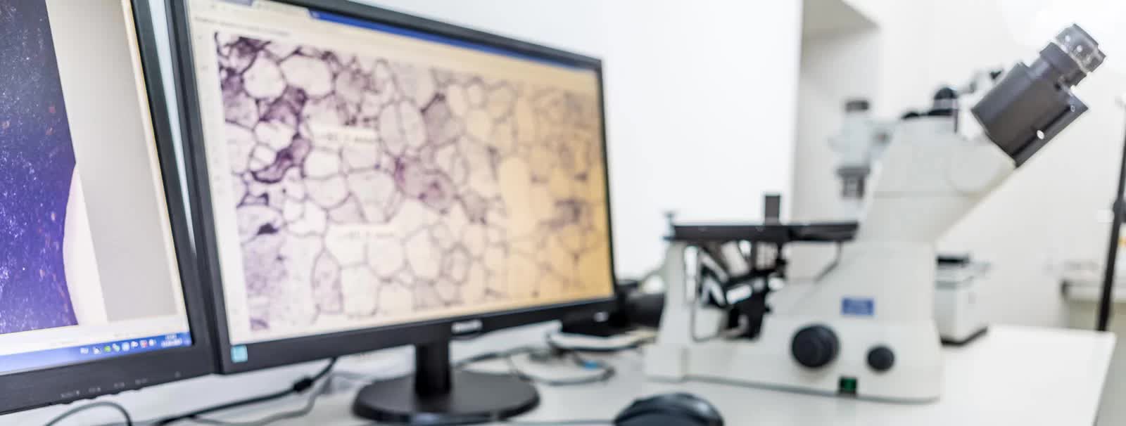 steel quality analysis